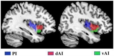 Altered functional connectivity of insular subregions in subjective cognitive decline